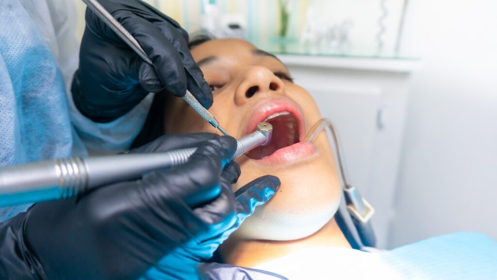 herbaluxy teeth whitening