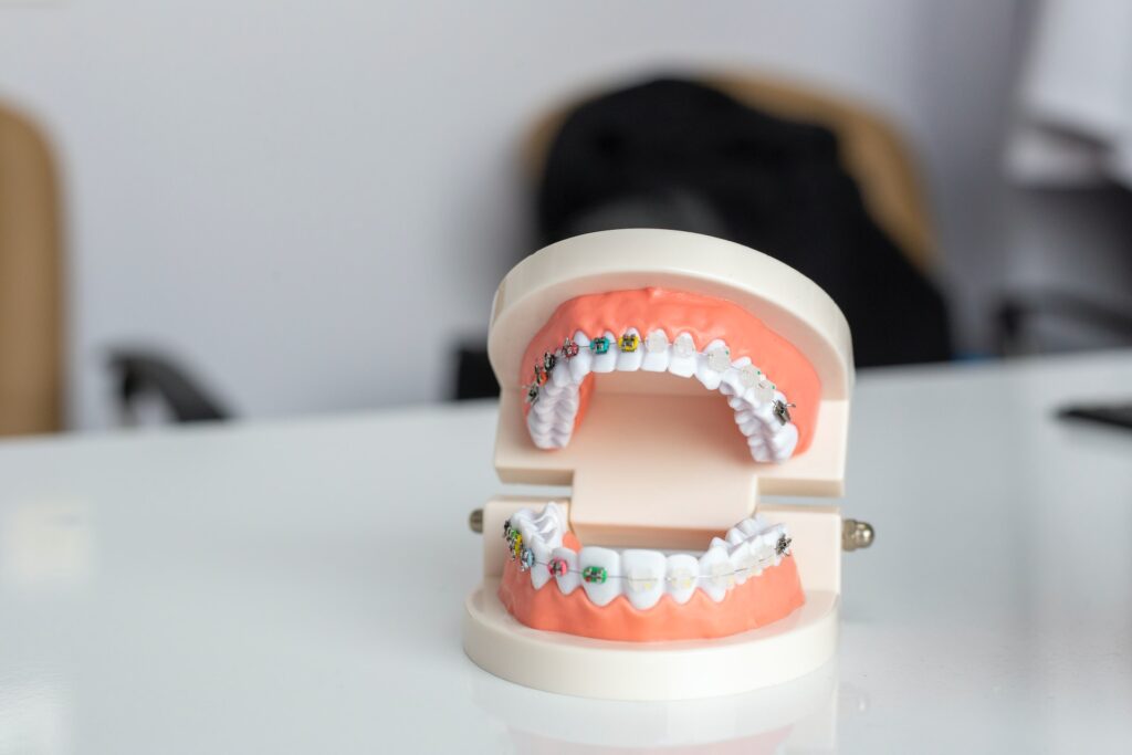 mouth shield for braces